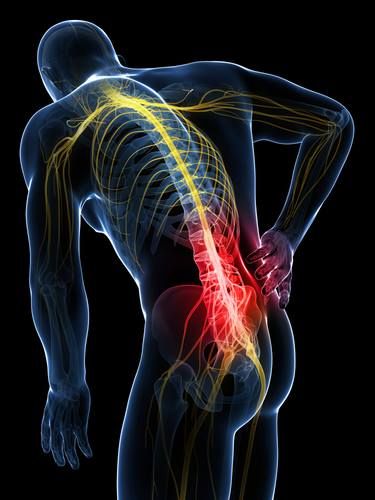 Low Back Pain