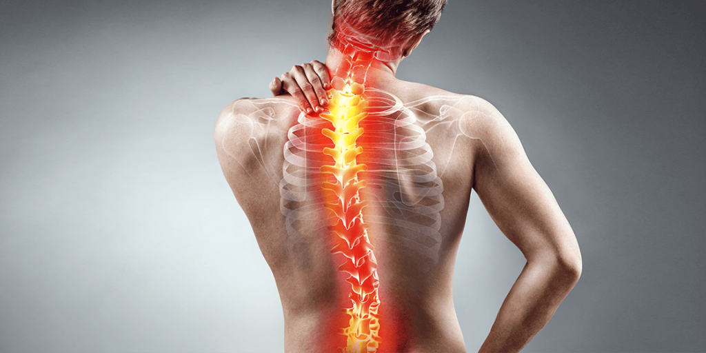 Scoliosis Surgery