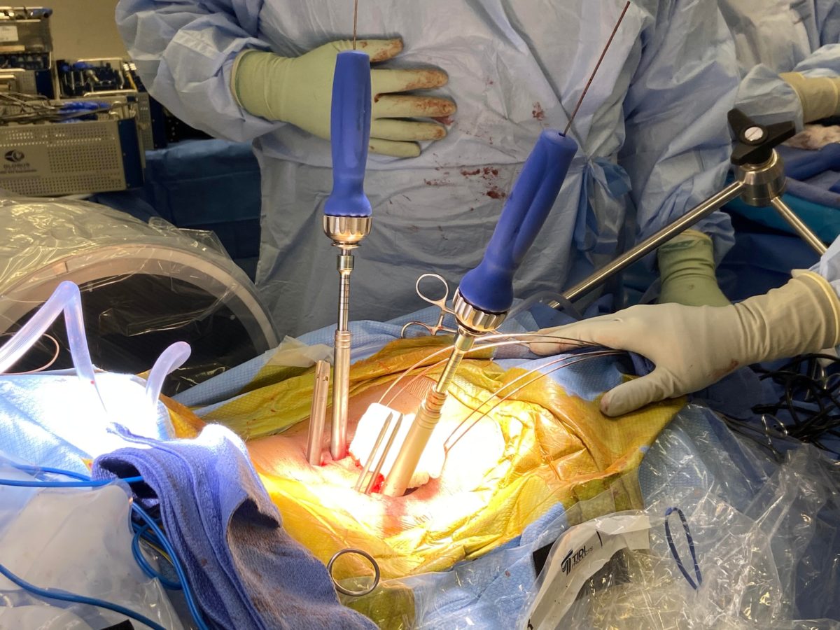MIS Spine Surgery